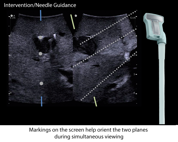 Intervention_Needle-Guidance_Biplane_Transducer_v3.png